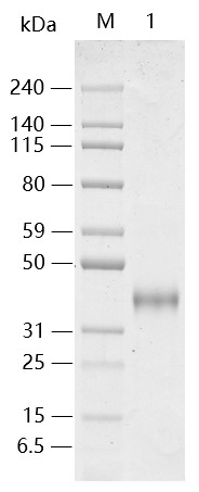 SARS-CoV-2 Spike Protein (RBD, K417N, Avi & His Tag)